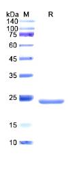 SDS-PAGE (CDC25B-1099H).jpg